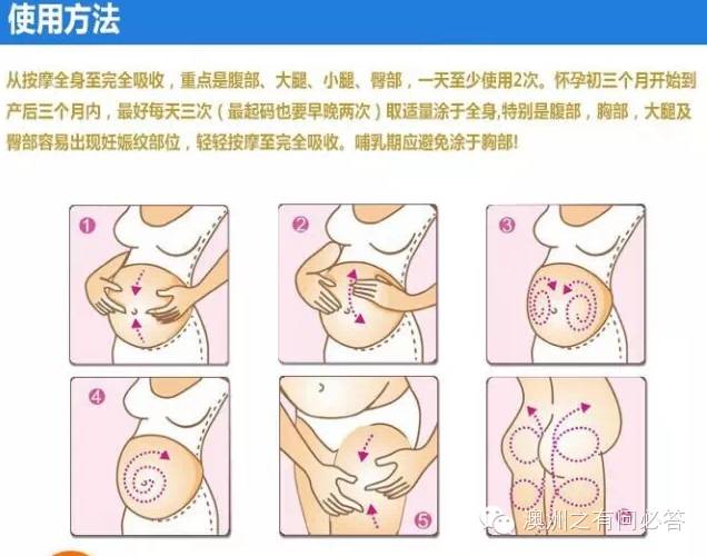 孕妇妊辰纹哪个牌子好_孕妇妊辰纹_孕妇用什么防止妊辰纹